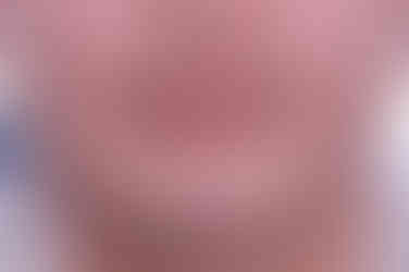 연산동임플란트