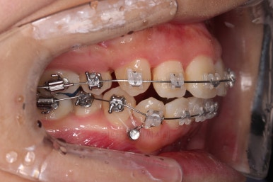 부산무턱교정치과