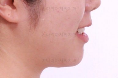 부산교정전문치과
