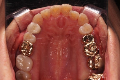 연산동부분교정