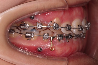 사직동교정치과