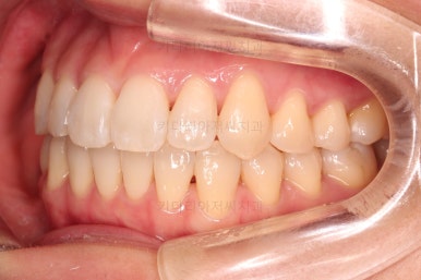 부산인비절라인