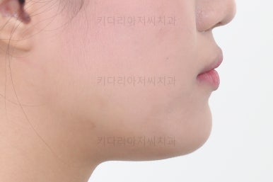 연산동치아교정치과