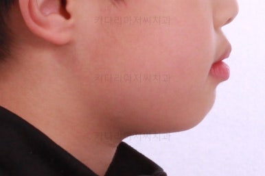 부산어린이교정