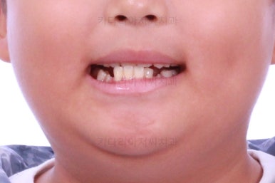 부산어린이교정