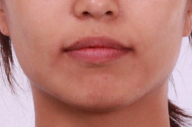 부산연산역치아교정