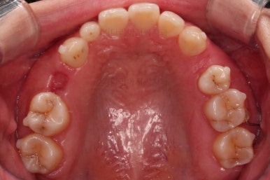 부산인비절라인