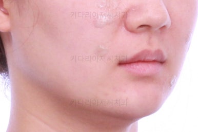 부산인비절라인