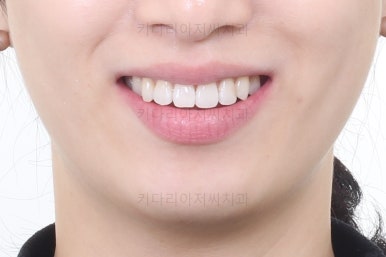 부산연산동부분교정