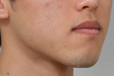 부산주걱턱교정