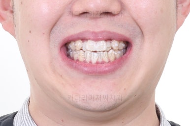 부산인비절라인