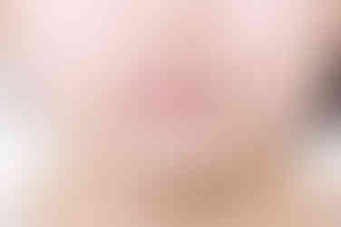 부산어린이치아교정