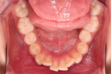 부산치아교정치과