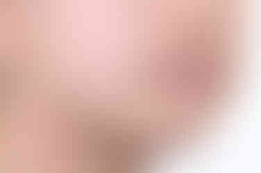 부산토끼치아교정