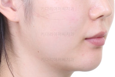 부산부분치아교정