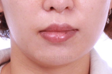 부산연산동교정치과