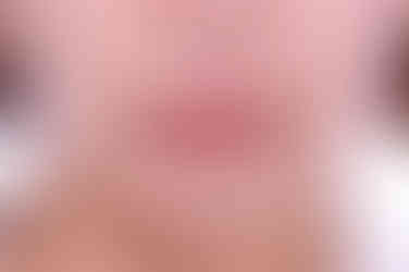 부산연산동교정치과