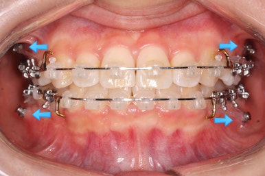 연산동교정치과