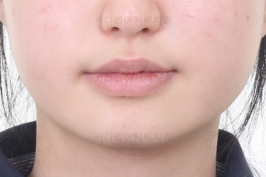 동래구치아교정