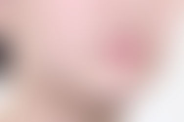 부산덧니교정