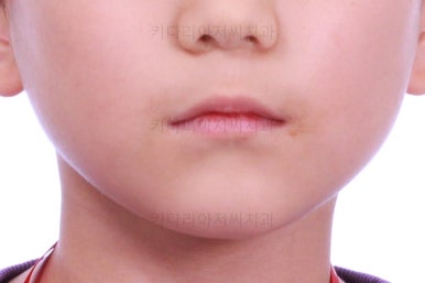 부산어린이교정