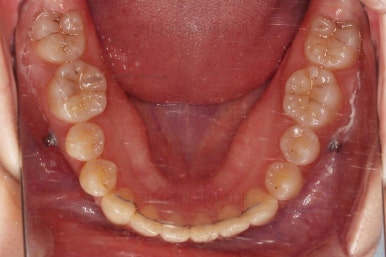 연산동교정치과