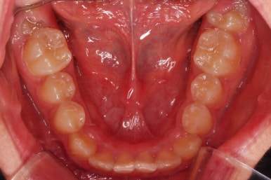 부산청소년교정