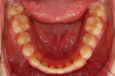 부산청소년교정