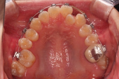 동래구치아교정
