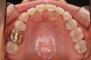 부산인비절라인