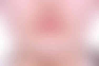 부산치아교정