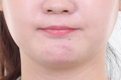 부산인비절라인