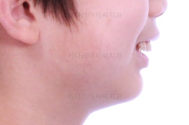 부산어린이교정