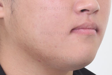 연산동교정