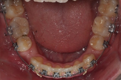 부산교정전문의