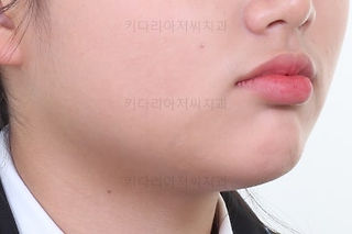 연산동치아교정