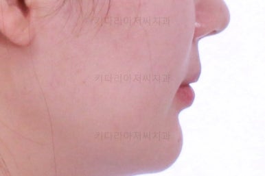 부산인비절라인