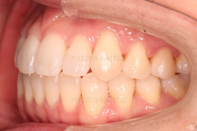 부산인비절라인