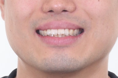 부산교정치과추천