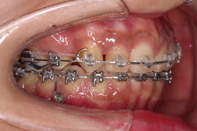 연산동교정치과