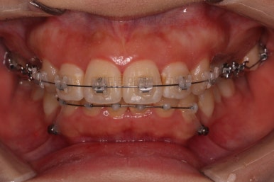 부산무턱교정치과
