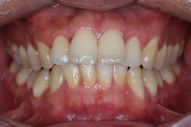 부산교정치과추천