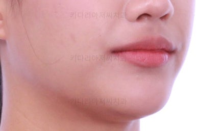 연산동치아교정치과