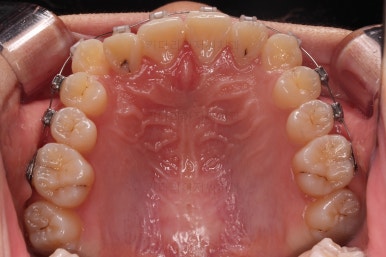 연산동교정치과