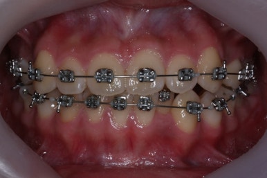 부산교정전문의