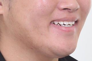 연산동교정