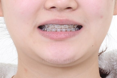 연산동교정치과