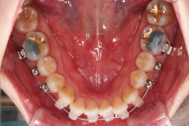 부산연산동치과