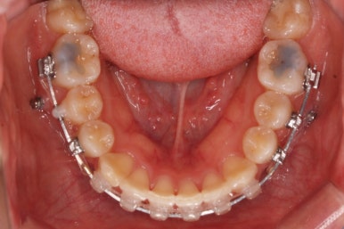 연산동교정치과