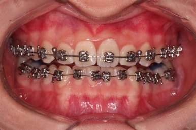 부산청소년교정치과